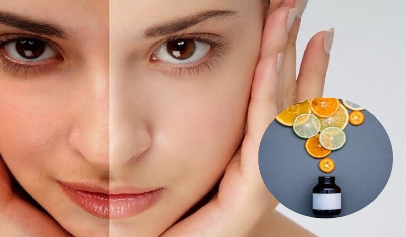Vitamin C Cho Da: Công Dụng, Cách Sử Dụng Và Những Điều Cần Biết Để Da Luôn Rạng Rỡ